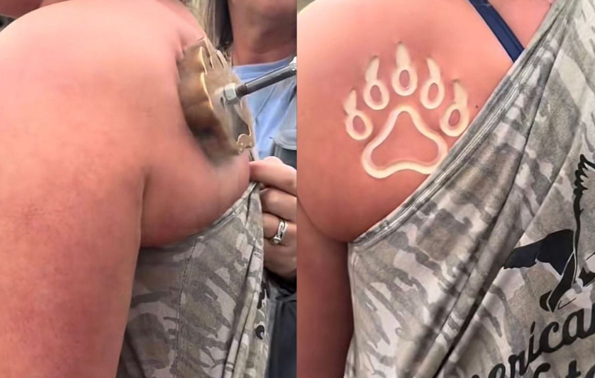 La tendance du freeze branding : un art ou un danger pour la santé ?