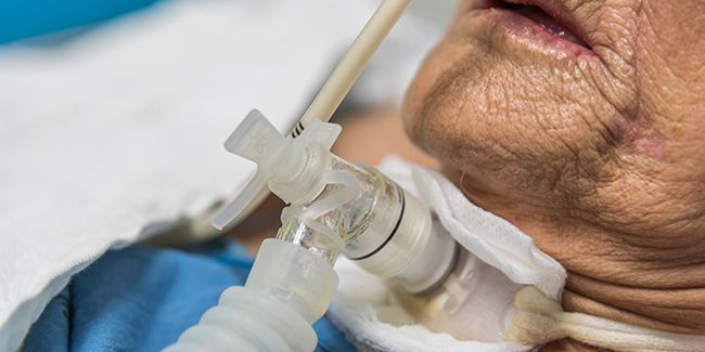 La maladie de Charcot : un défi médical majeur