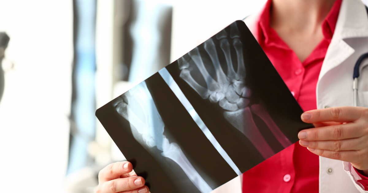 démarche responsable : comment se débarrasser des anciennes radiographies médicales