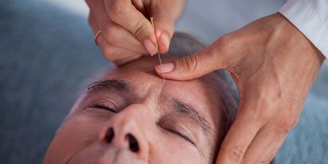 Découverte de l'acupuncture : un voyage vers le bien-être