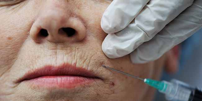 La chirurgie esthétique : un nouveau souffle pour les seniors